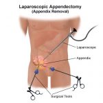 append-LAPS-1