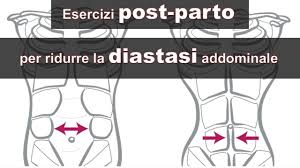 Risultati immagini per diastasi dei retti addominali esercizi